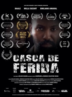 Casca de ferida